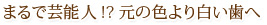 まるで芸能人!?元の色より白い歯へ